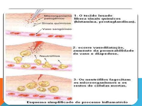 MEDICINA BUCAL Hiperplasia gingival por obstrucción de vías respiratorias